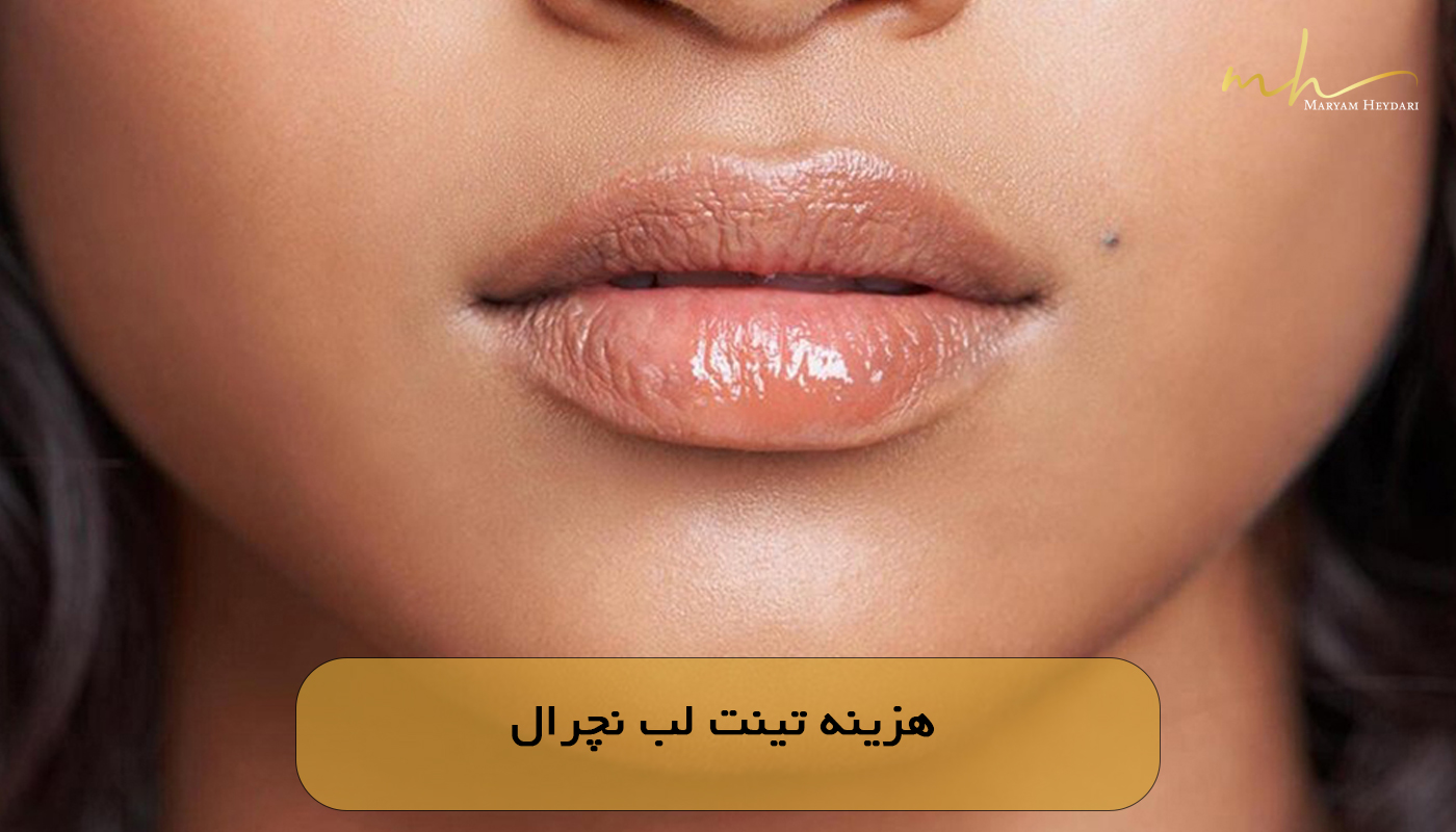 هزینه تینت لب نچرال