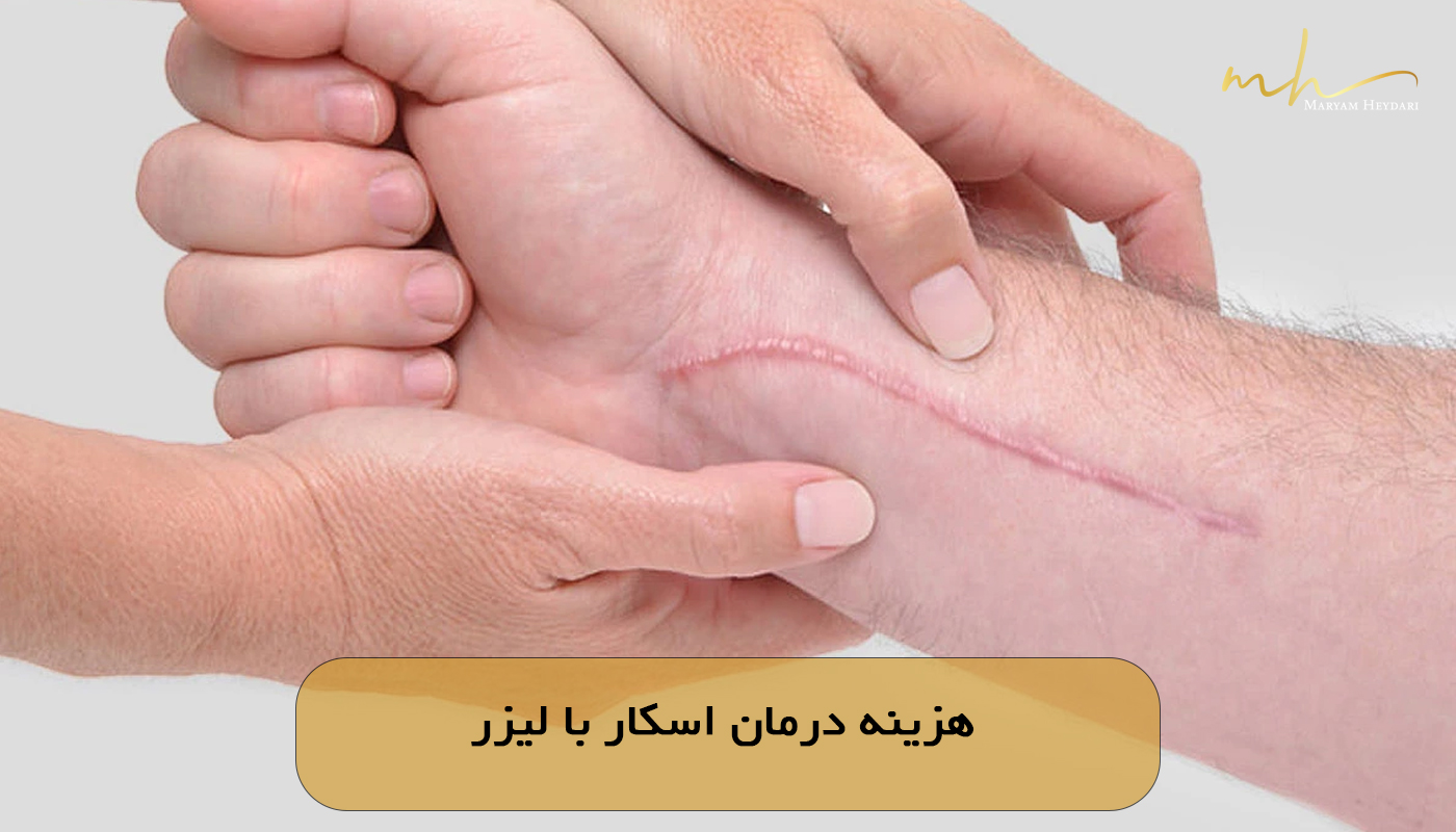 هزینه درمان اسکار با لیزر