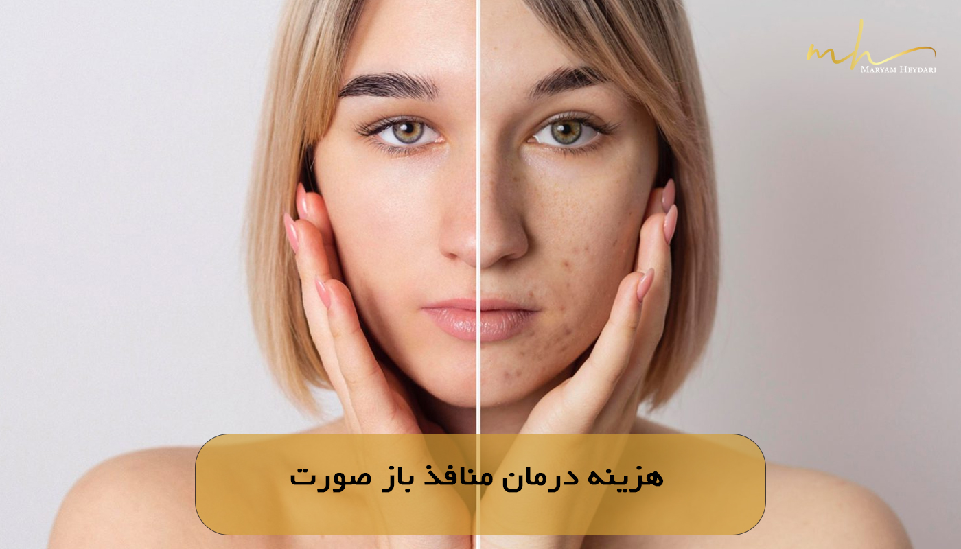 هزینه درمان منافذ باز صورت