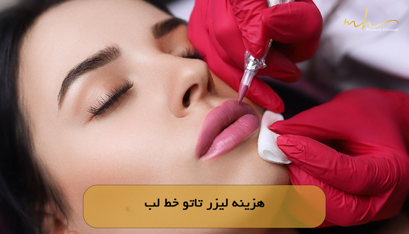 هزینه لیزر تاتو خط لب