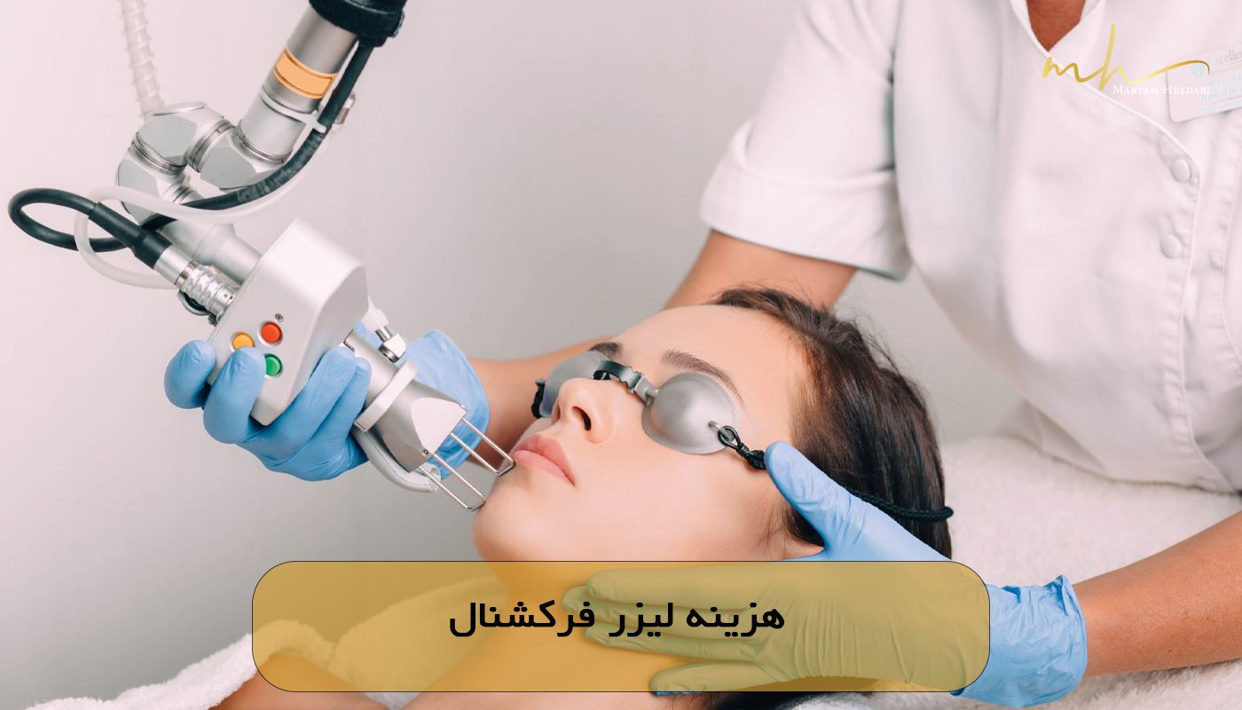 هزینه لیزر فرکشنال