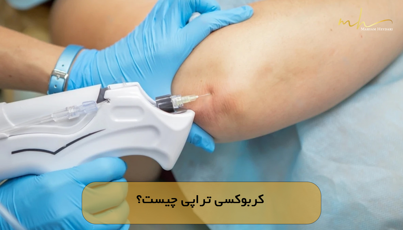 کربوکسی تراپی چیست؟