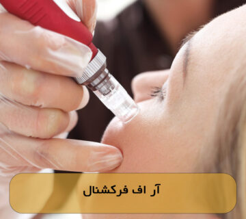 آر اف فرکشنال