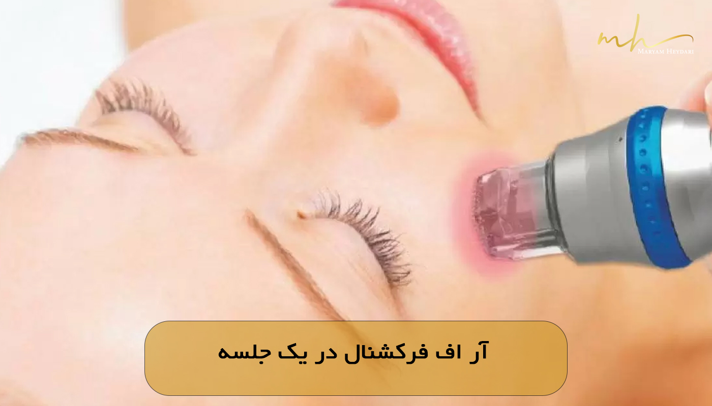 آر اف فرکشنال در یک جلسه