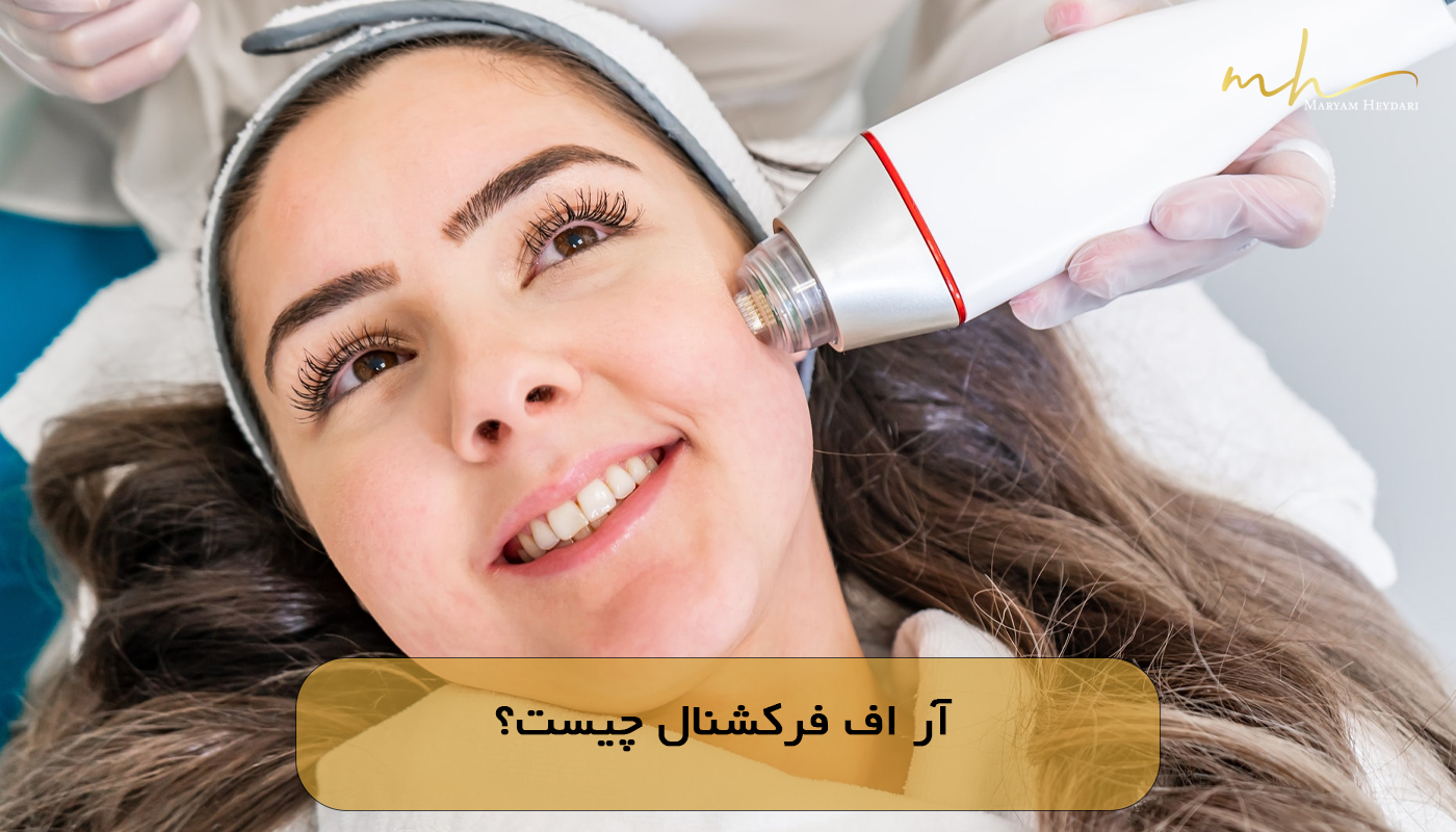 آر اف فرکشنال چیست؟