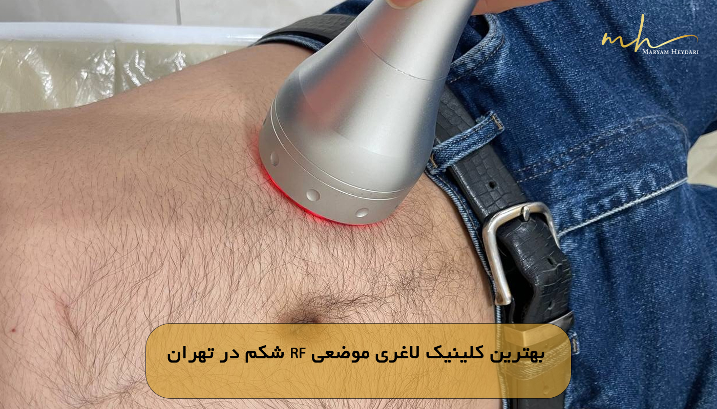 بهترین کلینیک لاغری موضعی RF شکم در تهران