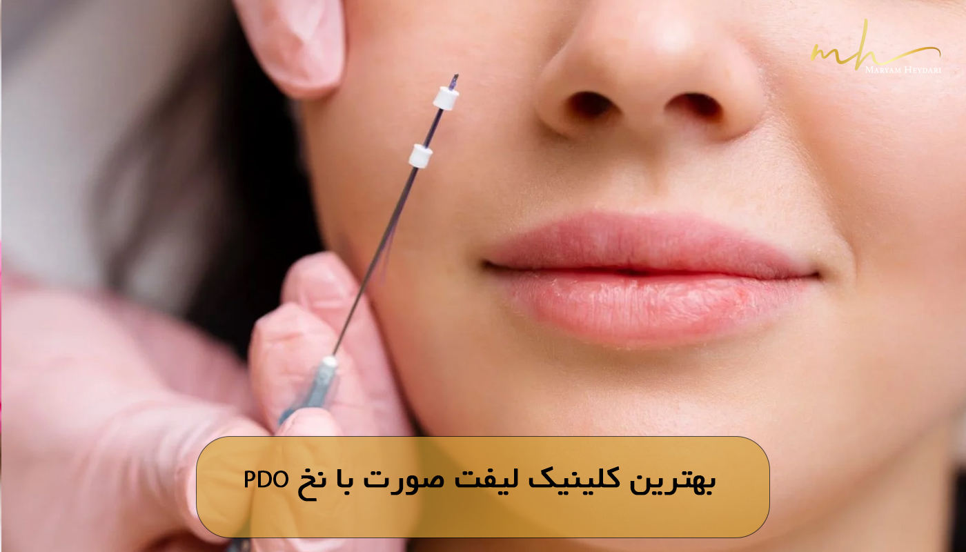 بهترین کلینیک لیفت صورت با نخ PDO