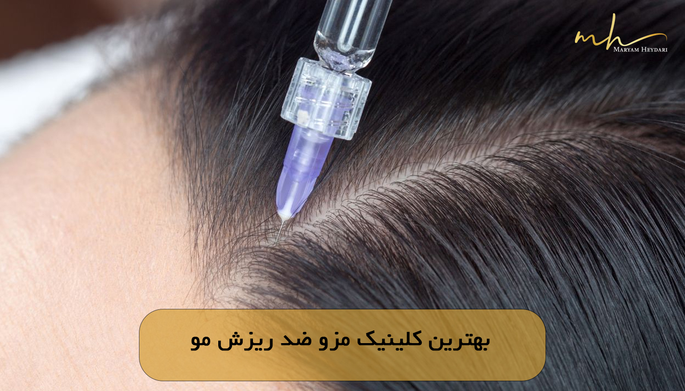 بهترین کلینیک مزو ضد ریزش مو