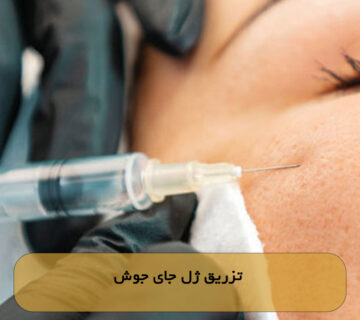 تزریق ژل جای جوش
