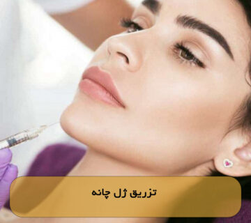 تزریق ژل چانه