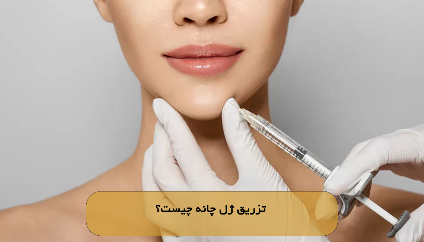 تزریق ژل چانه چیست؟