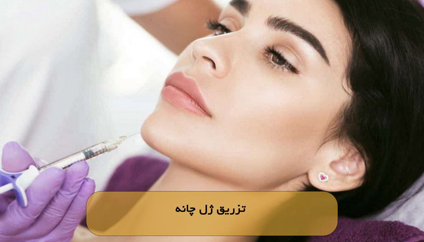 تزریق ژل چانه