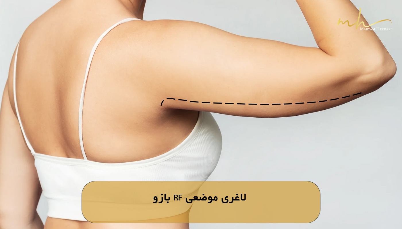 لاغری موضعی RF بازو