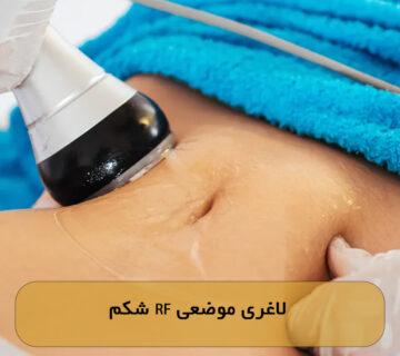 لاغری موضعی RF شکم
