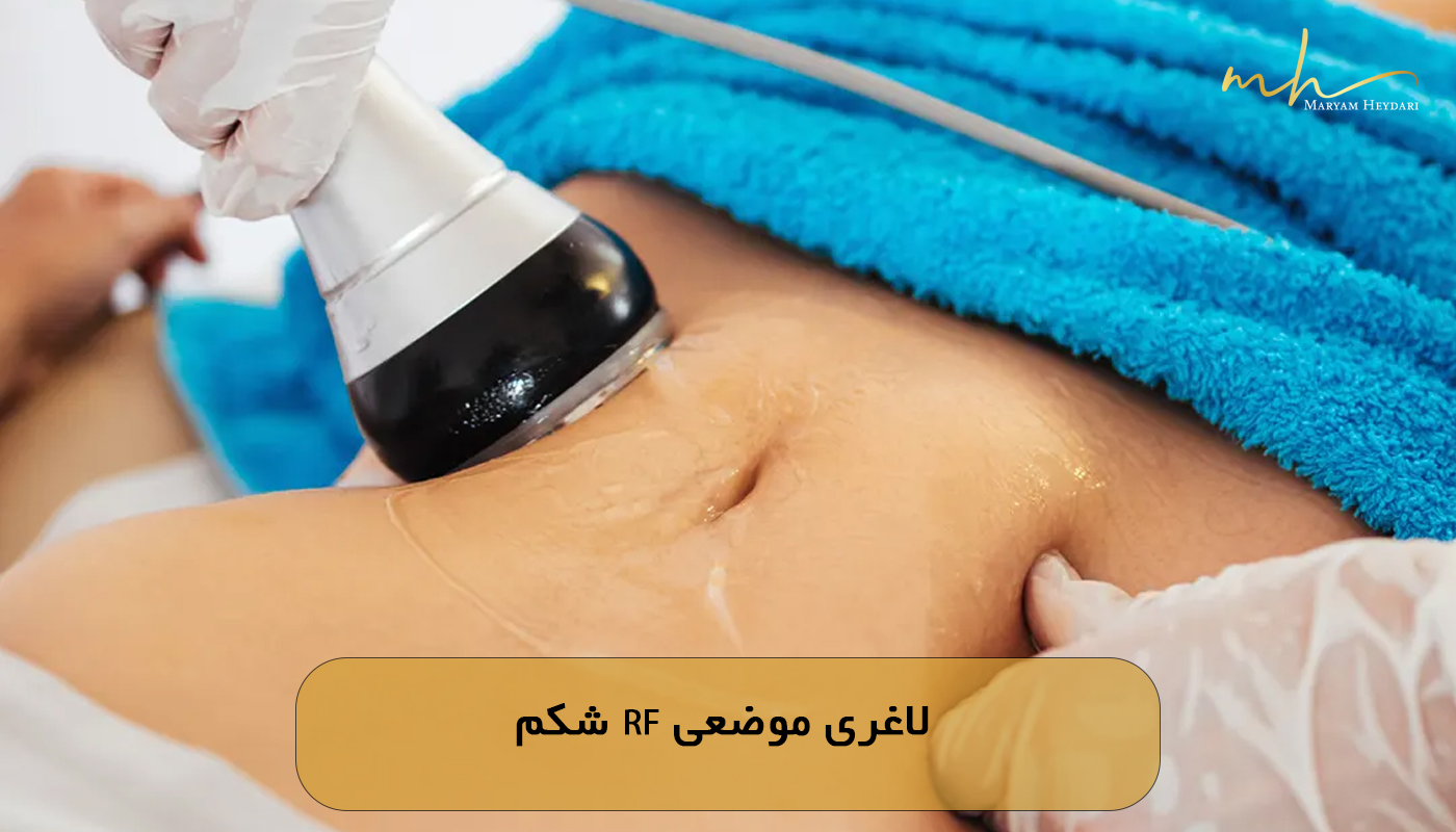 لاغری موضعی RF شکم