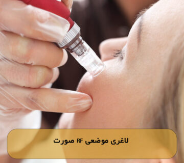 لاغری موضعی RF صورت