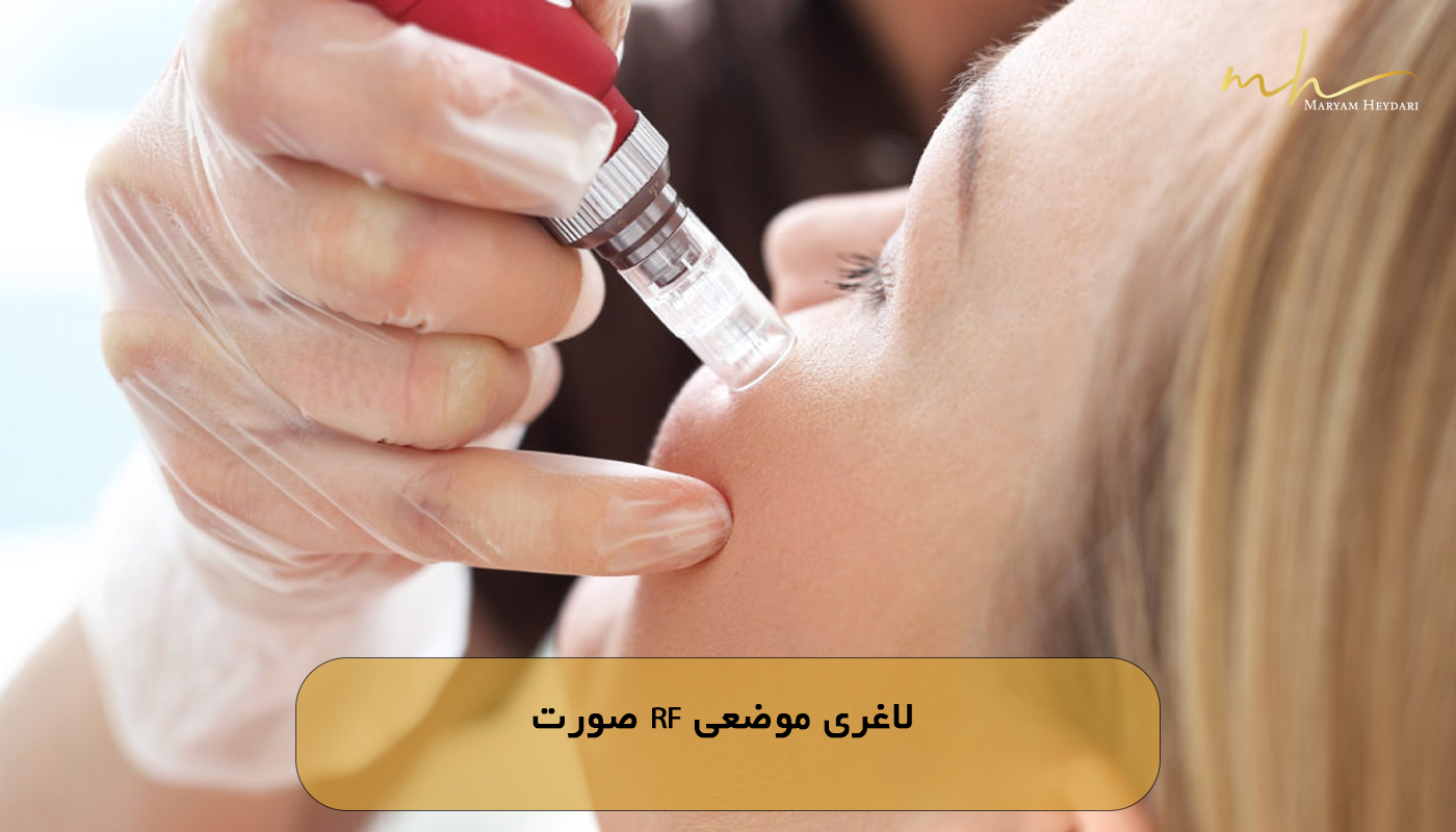 لاغری موضعی RF صورت
