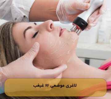 لاغری موضعی RF غبغب