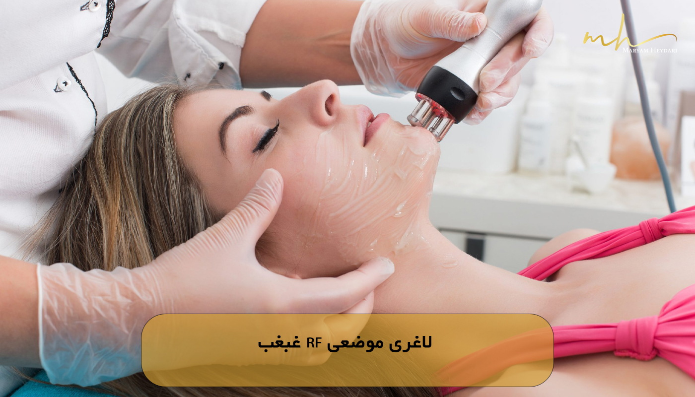 لاغری موضعی RF غبغب