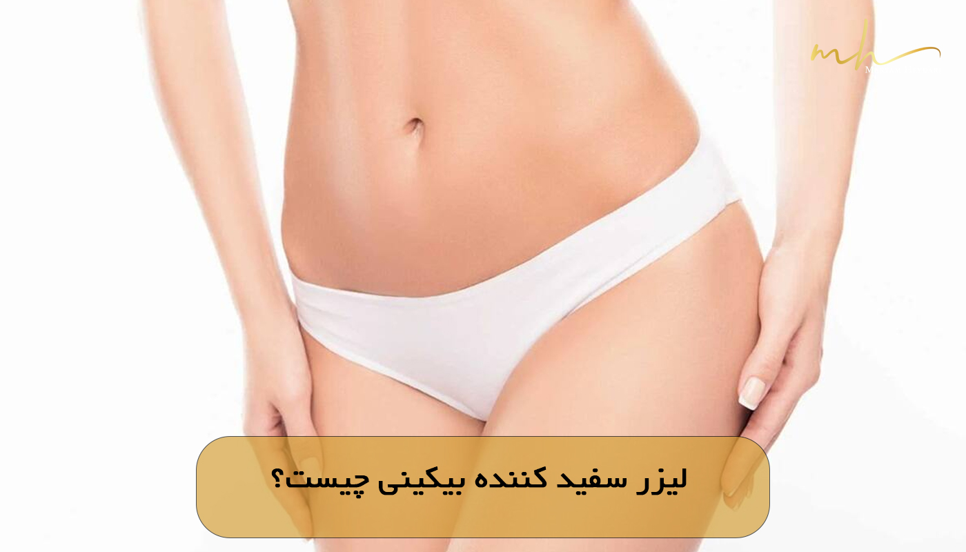 لیزر سفید کننده بیکینی چیست؟