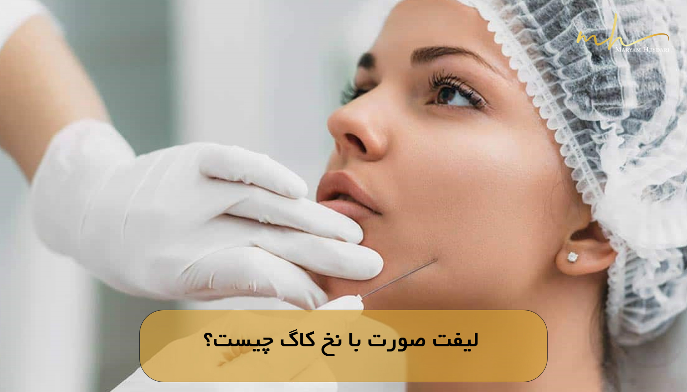 لیفت صورت با نخ کاگ چیست؟