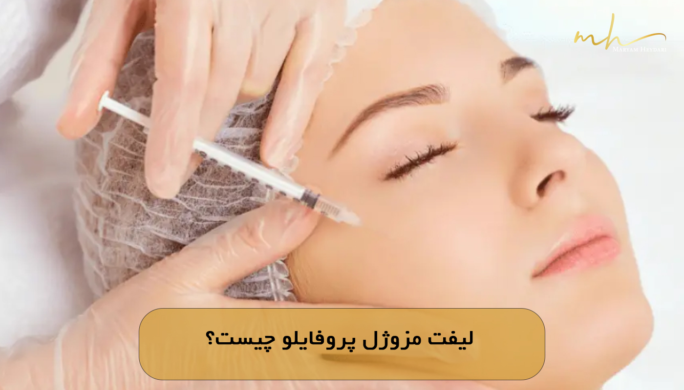 لیفت مزوژل پروفایلو چیست؟
