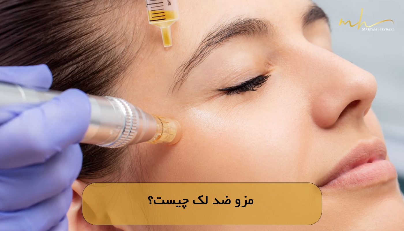 مزو ضد لک چیست؟