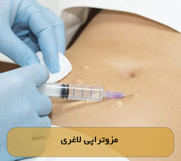 مزوتراپی لاغری