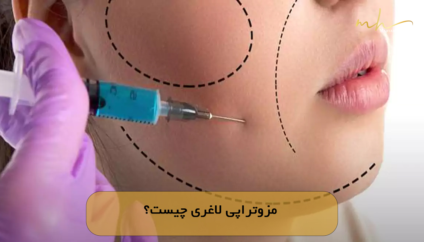 مزوتراپی لاغری چیست؟