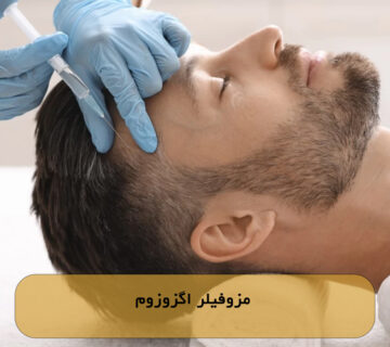 مزوفیلر اگزوزوم