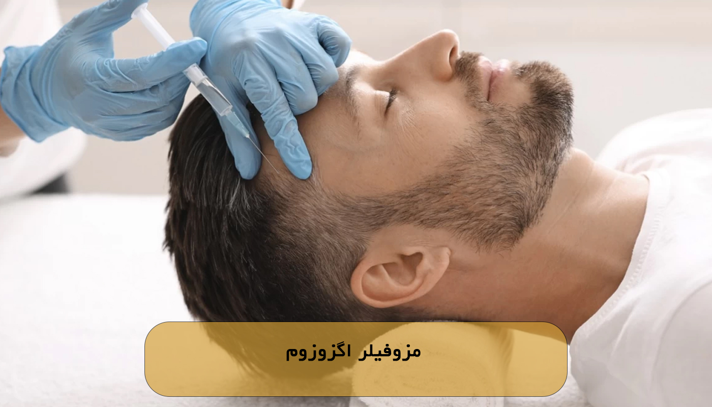 مزوفیلر اگزوزوم