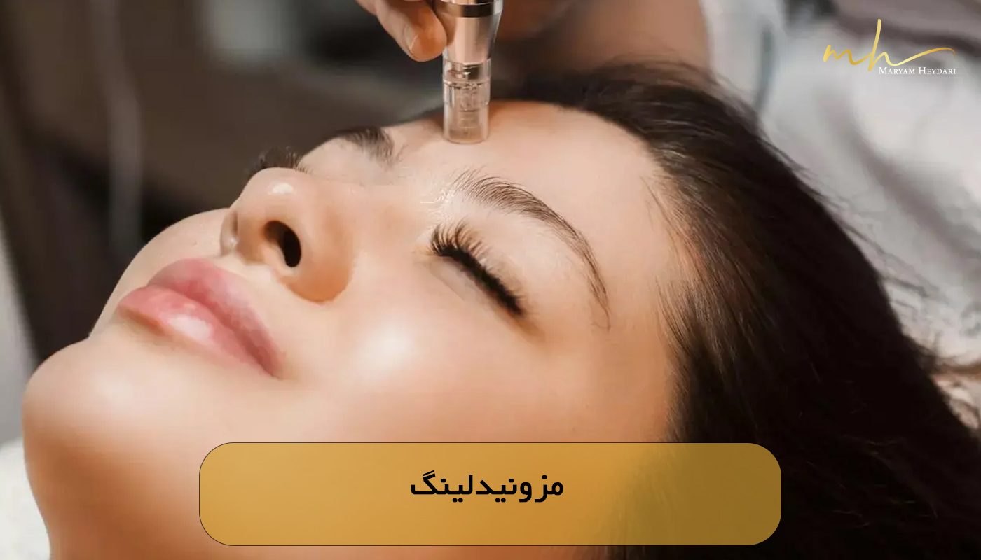 مزونیدلینگ