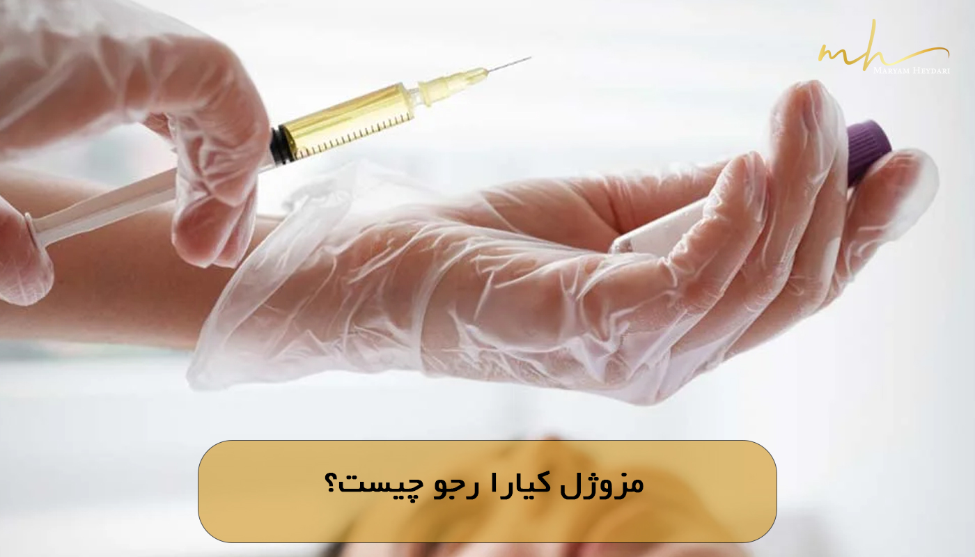 مزوژل کیارا رجو چیست؟