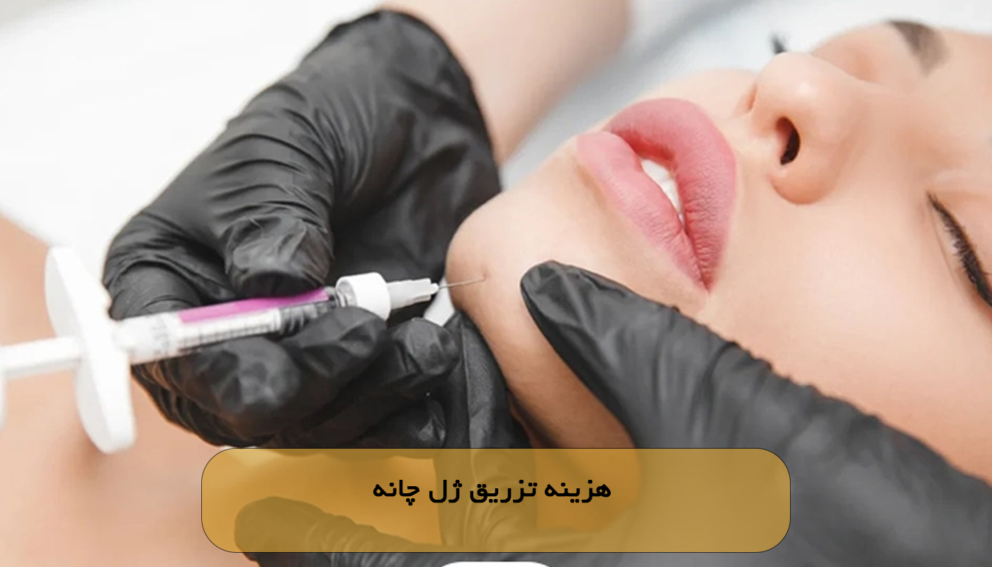 هزینه تزریق ژل چانه