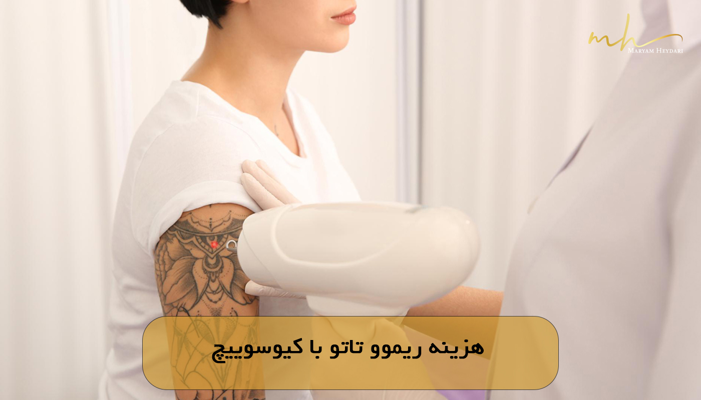 هزینه ریموو تاتو با کیوسوییچ