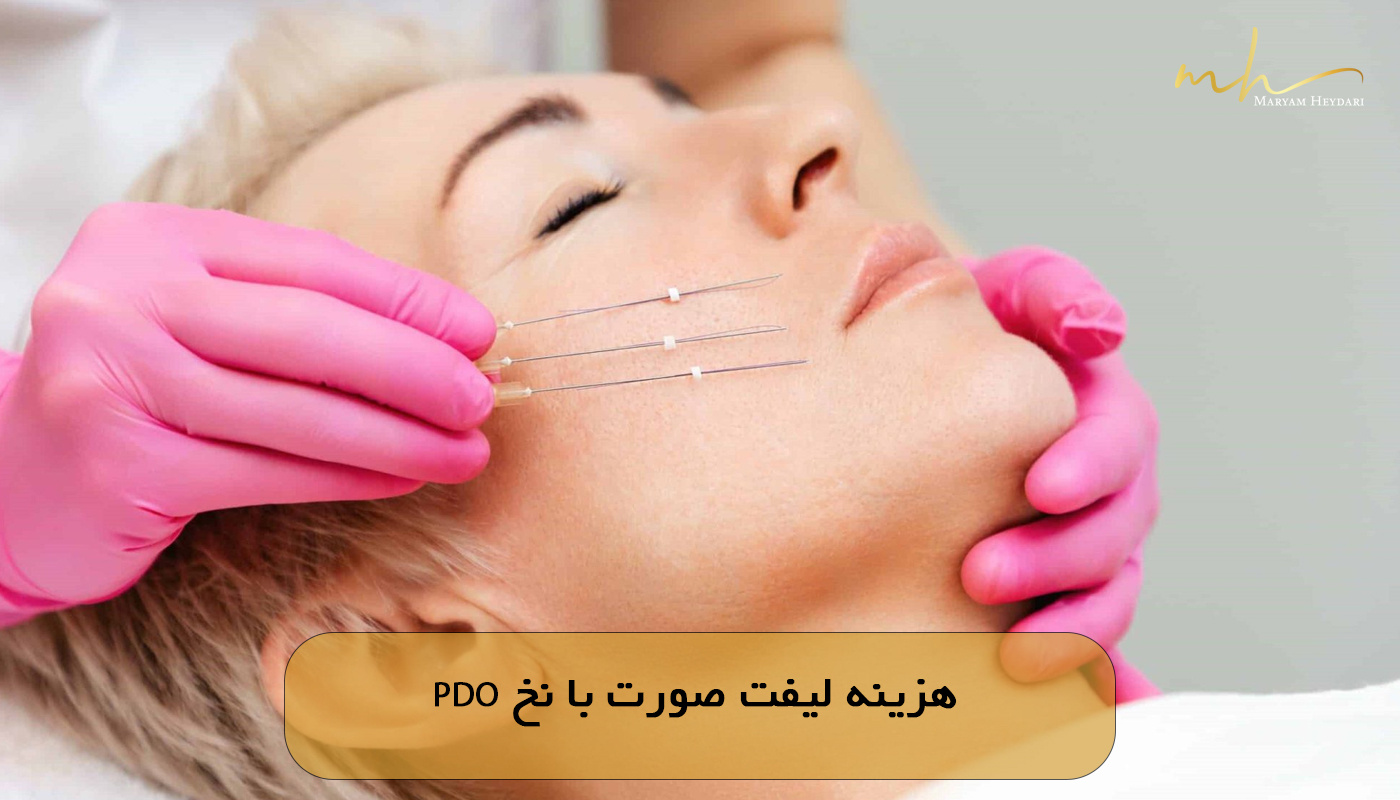 هزینه لیفت صورت با نخ PDO