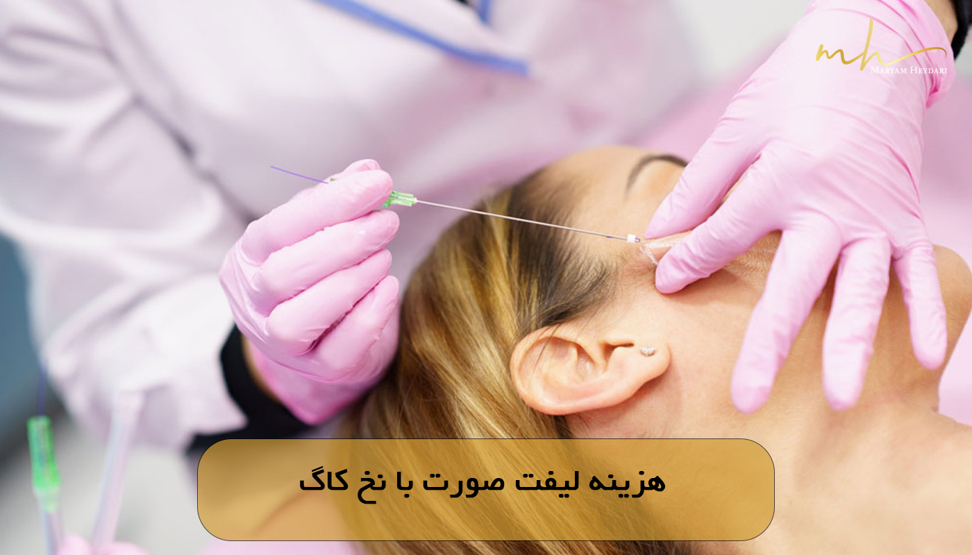 هزینه لیفت صورت با نخ کاگ