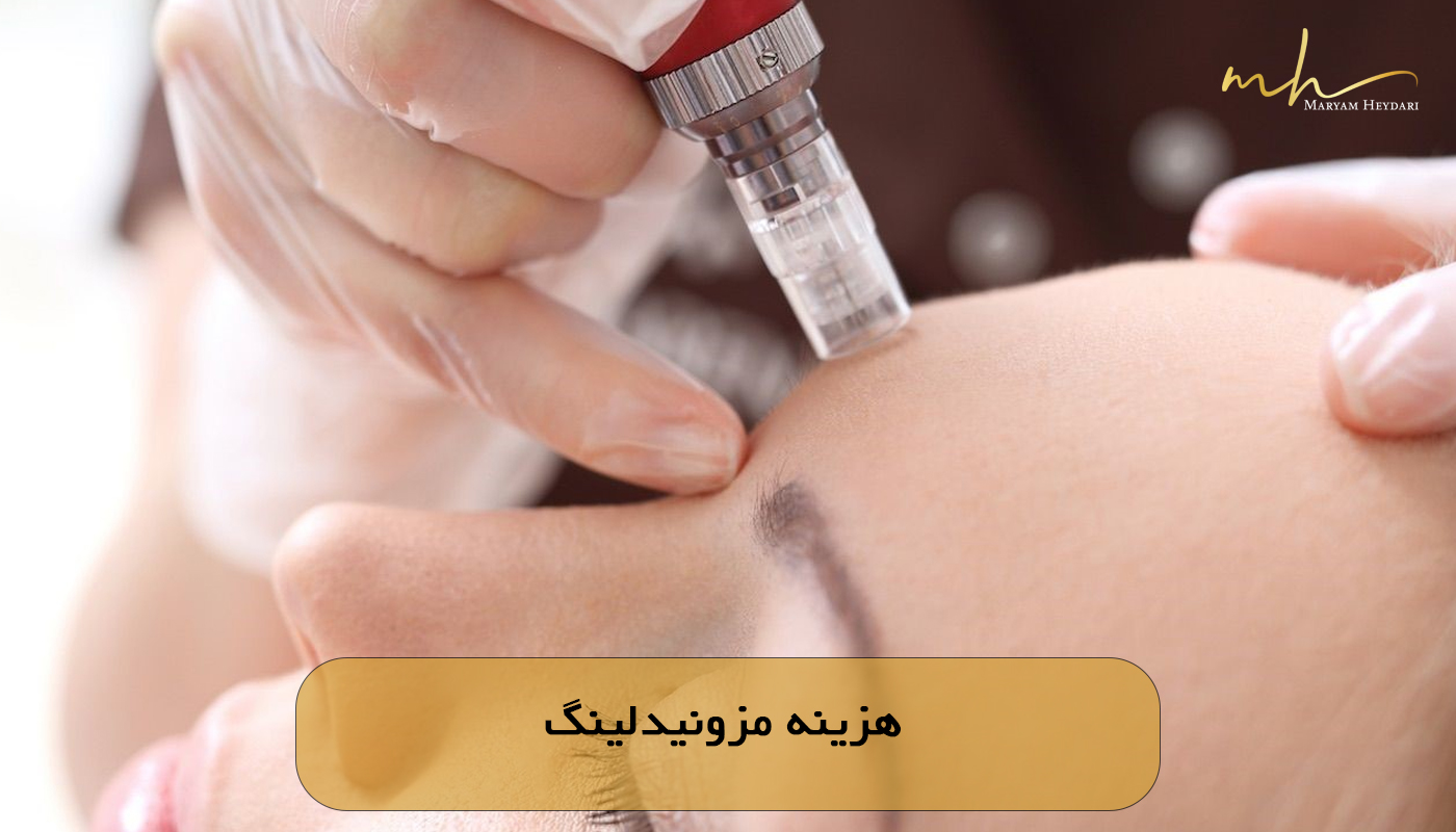 هزینه مزونیدلینگ