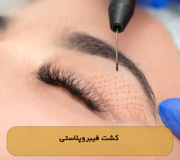 کشت فیبروپلاستی