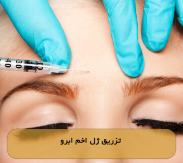 تزریق ژل اخم ابرو