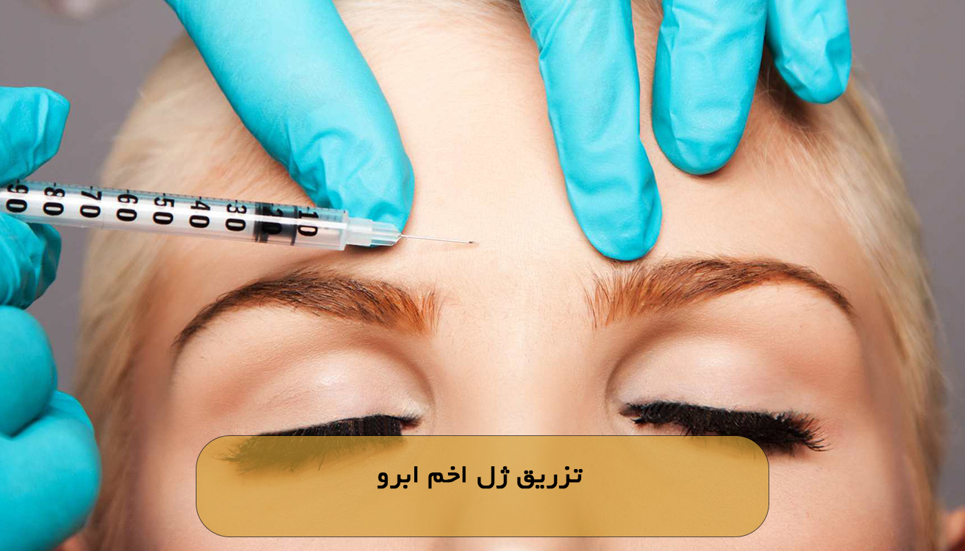 تزریق ژل اخم ابرو