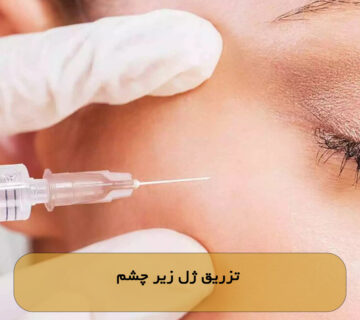 تزریق ژل زیر چشم