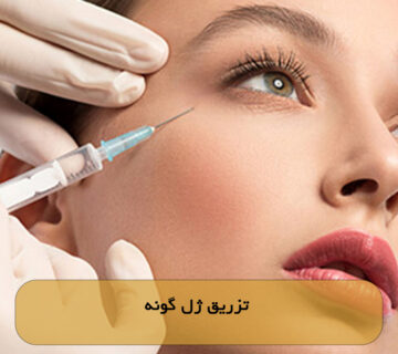 تزریق ژل گونه