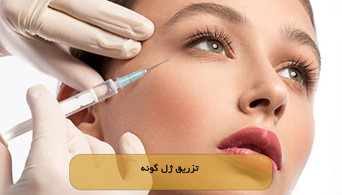 تزریق ژل گونه