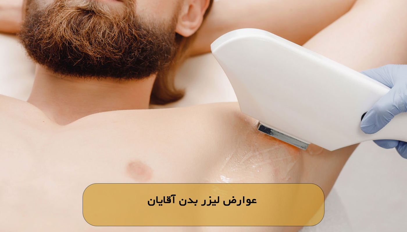 عوارض لیزر بدن آقایان
