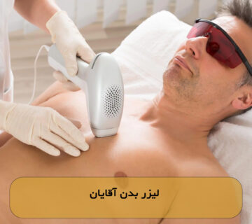 لیزر بدن آقایان