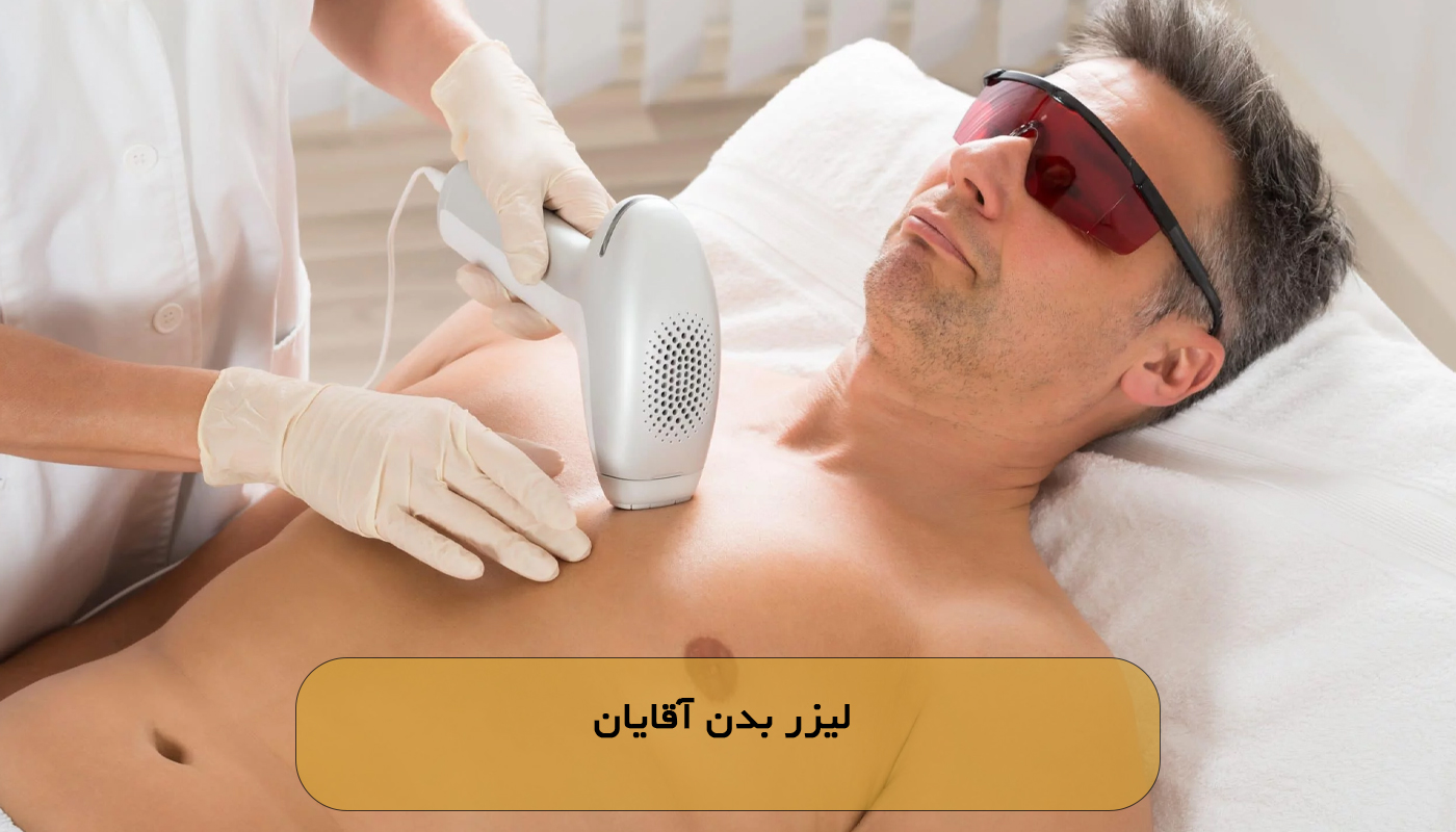 لیزر بدن آقایان