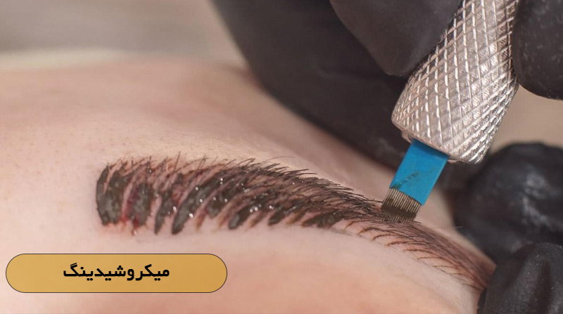 میکروشیدینگ