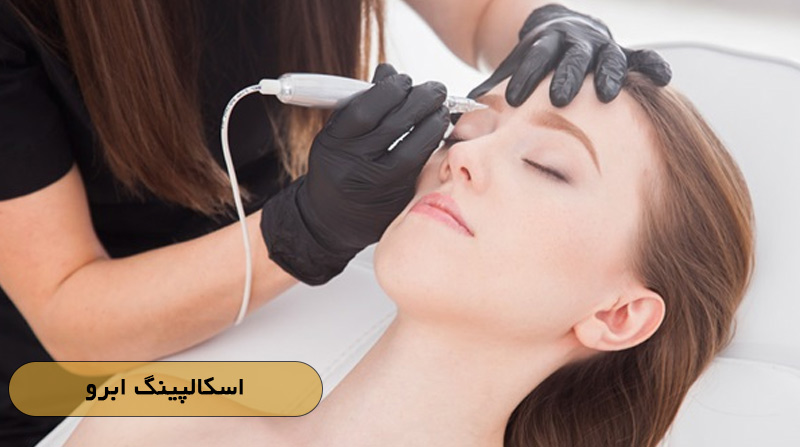 اسکالپینگ ابرو