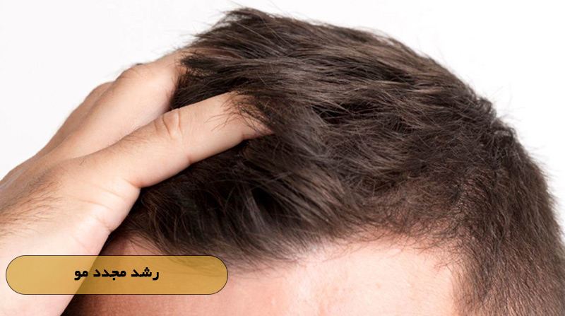 رشد مجدد مو